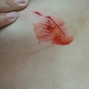 布尔戈斯vs拉斯彭马斯_罕见!大连钓友钓到一条20斤大鲅鱼布尔戈斯vs拉斯彭马斯,反被鲅鱼利齿咬伤胸部