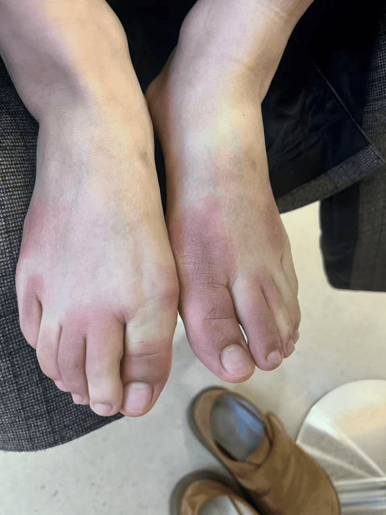 皇冠登录网址_东北姑娘来浙江后崩溃了皇冠登录网址，穿3条加绒裤还冻到发抖！南方人冬天怎么保命，网友吵翻！