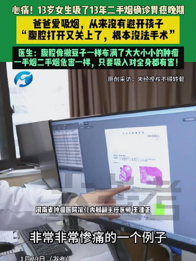 正版皇冠信用网出租_爸爸常年在家吸烟正版皇冠信用网出租,13岁女儿吸13年二手烟腹腔内长满肿瘤